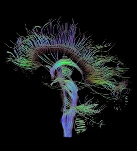 Reconstructed white matter fiber tracts of the brain, brainstem, and spinal cord. View through the mid-sagittal plane.