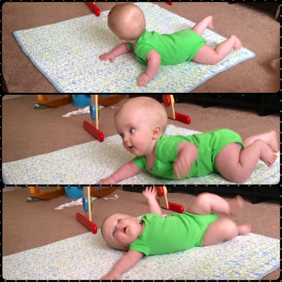 Baby boy with hydrocephalus