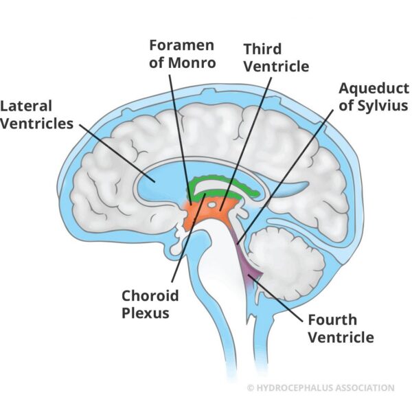 Ventricles